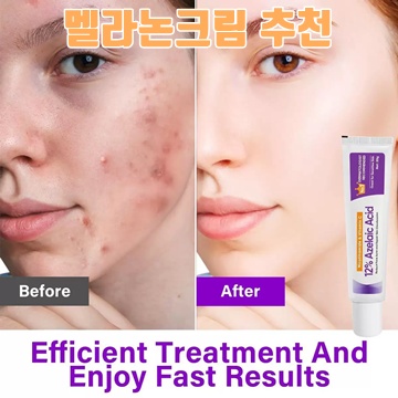 멜라논크림 효과와 사용법 완벽 가이드